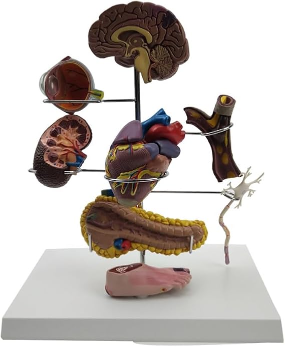 Diabetes Anatomy Model Set