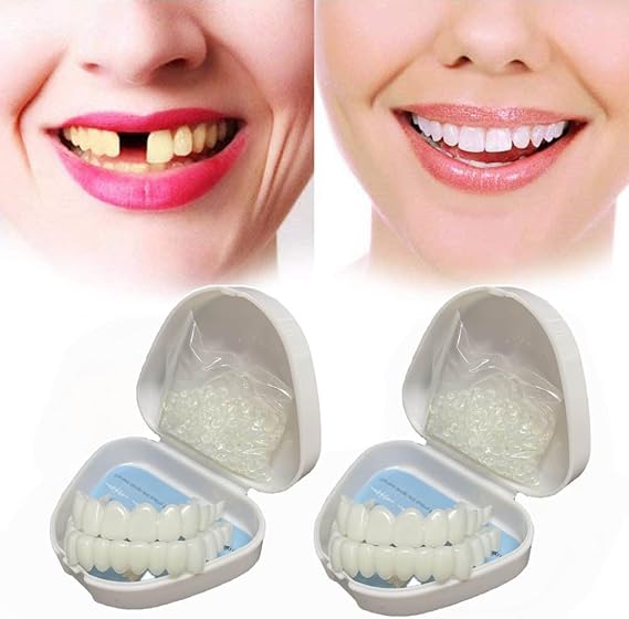 2 Pairs False Teeth Veneers Clip in Veneers Teeth Fake Teeth, Snap on Veneers Teeth Upper And Lower False Teeth Snap on Perfect Smile Confidence in Minutes at Home [Energy Class A]