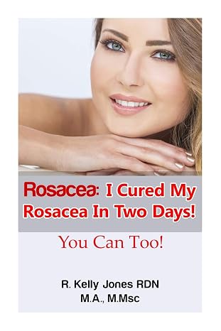 Rosacea:I Cured My Rosacea In Two Days! You Can Too!