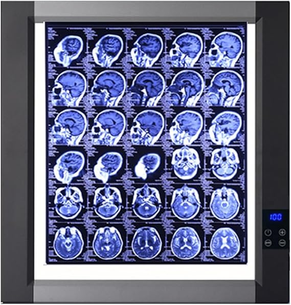 X-ray Film Illuminator Light Box, X-Ray LED Viewbox, X-Ray Viewer Light Panel for Hospital X-Film or CT-Film Lab Equipment(19x20in/48x50.5cm)